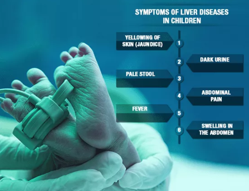 symptoms of liver diseases in children