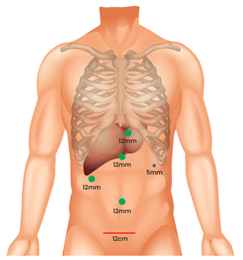 liver Graph