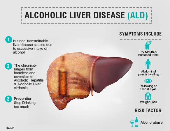 Alchoholic Liver Diseases: Symptoms and Treatment - AILBS ...