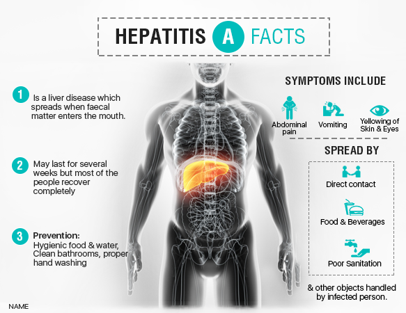 Image result for hepatitis A