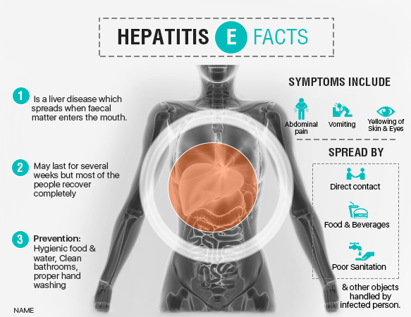 What Is Hepatitis A What Is Hepatitis E Best Liver Transplant