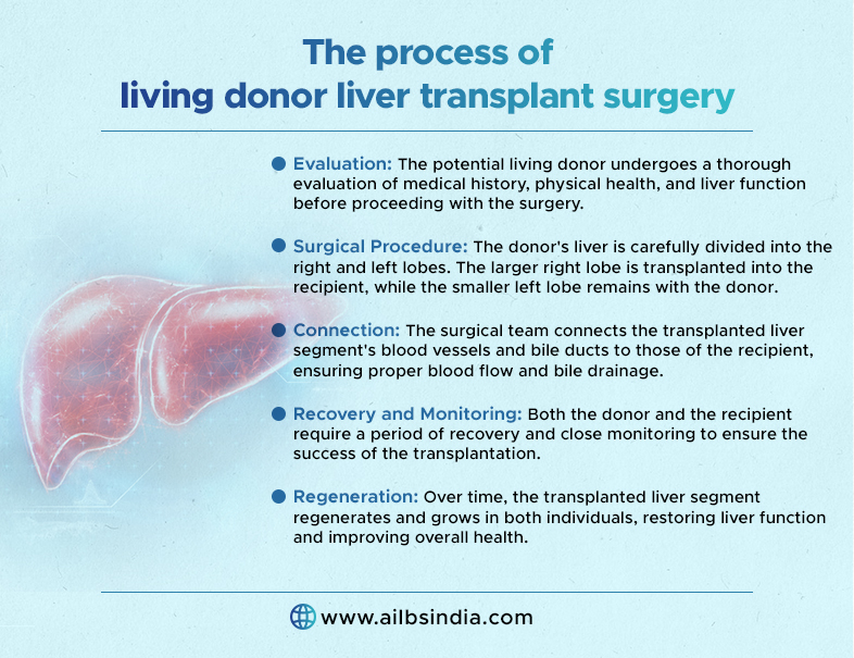 procces of living donor liver transplant surgery