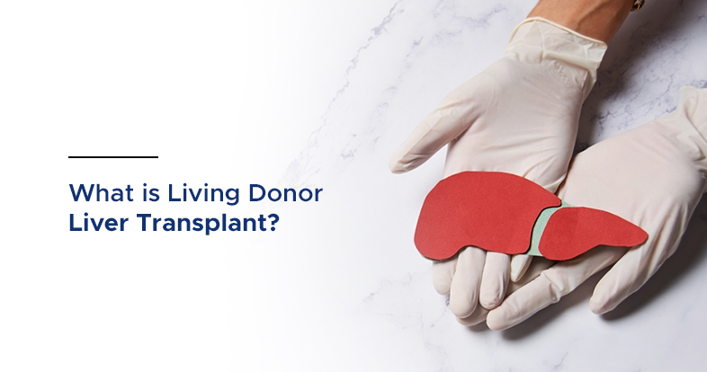 what is living donor liver transplant