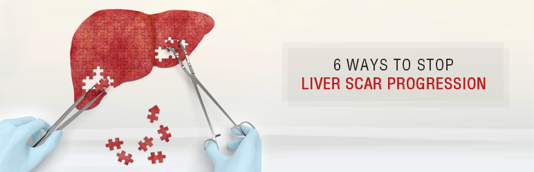  liver scar progression