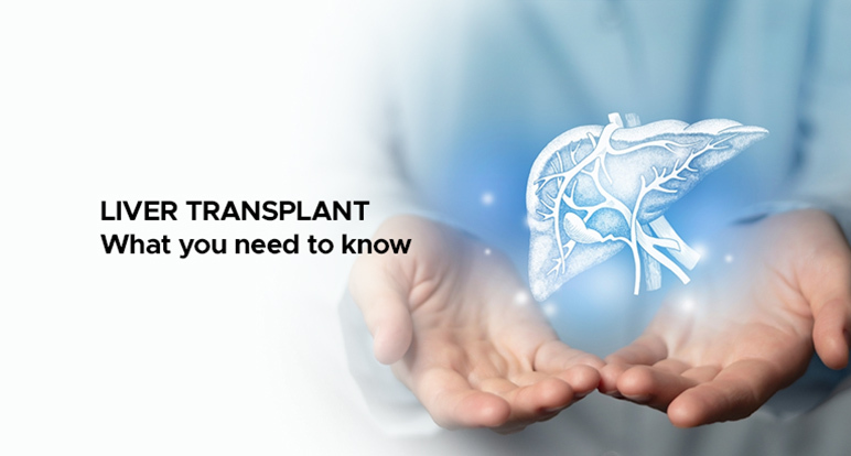 liver transplant