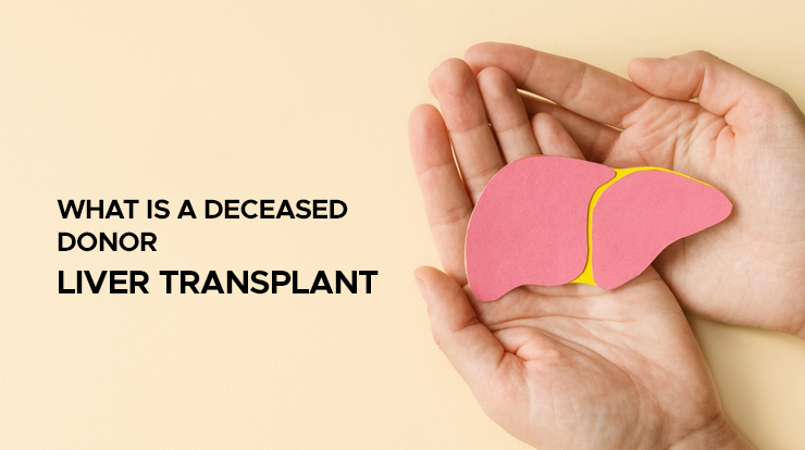 what is a deceased donor (cadaveric) liver transplant
