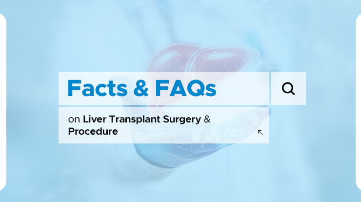 facts and faqs on liver transplant surgery & procedure