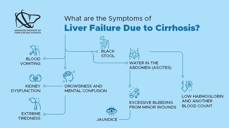 what are the symptoms of liver failure due to cirrhosis