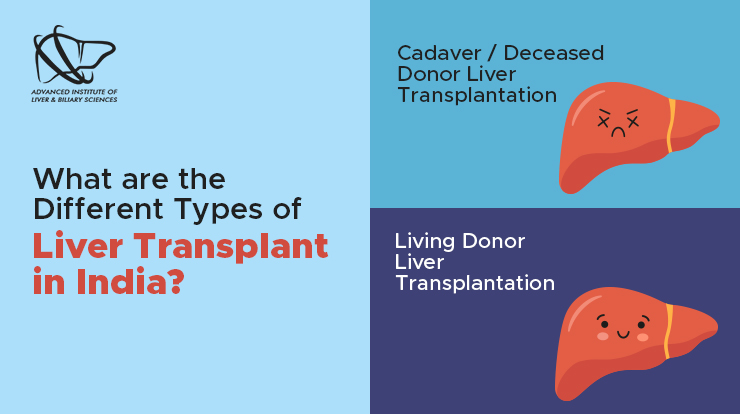 what are the different types of liver transplant in india