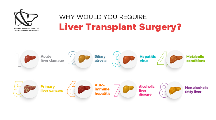 why would you require liver transplant surgery
