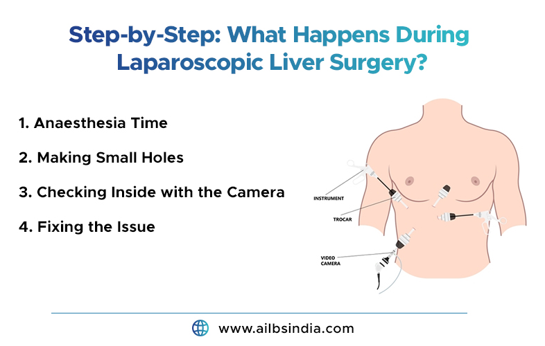 what happens during laparoscopic liver surgery