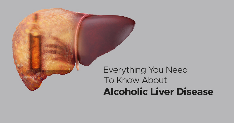 everything you should know about alcoholic liver disease