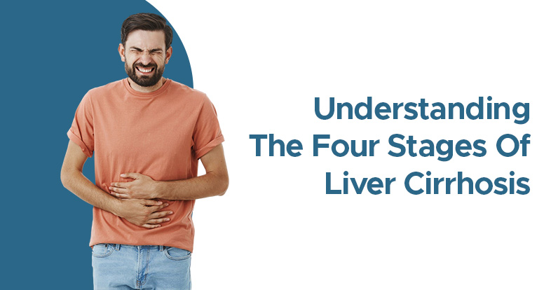 the four stages of liver cirrhosis