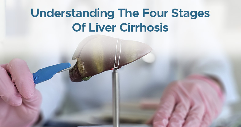 understanding the four stages of liver cirrhosis