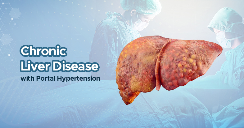 chronic liver disease with portal hypertension