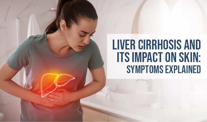 liver cirrhosis and its impact on skin: symptoms explained